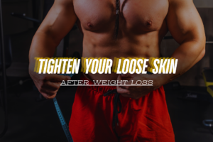 How to Tighten Your Loose Skin After Weight Loss?